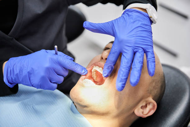 Best Emergency Tooth Extraction in Henrietta, TX